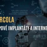 Dr. Mercola: Lidské mikročipové implantáty a internet těl