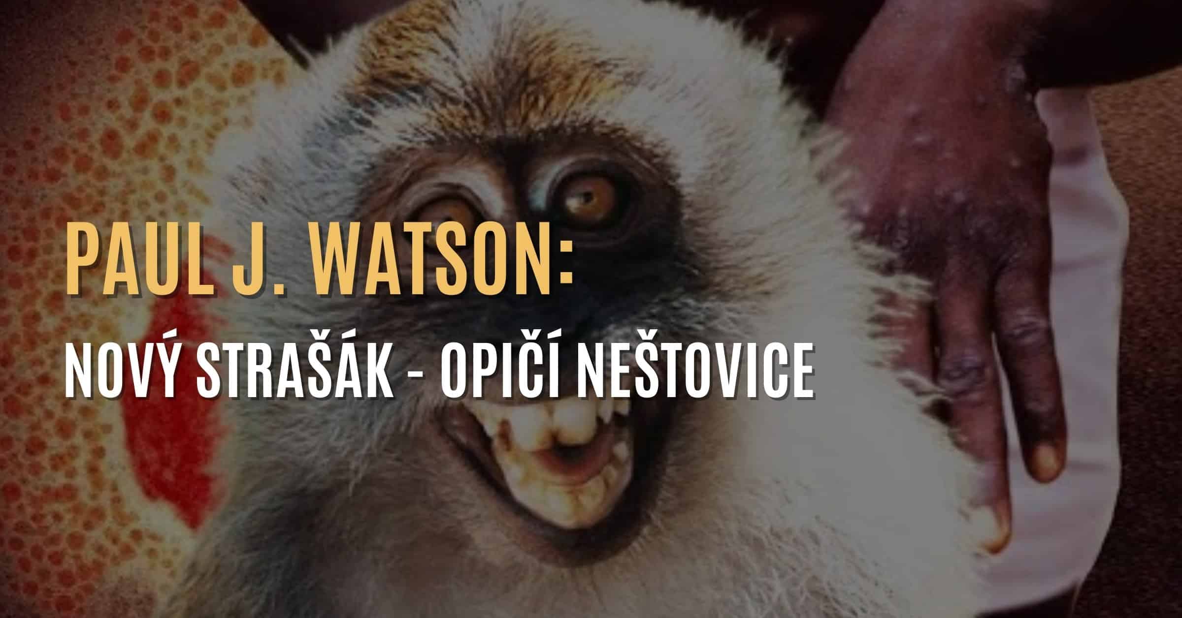 Paul J. Watson: Nový strašák – Opičí neštovice 🙉