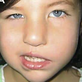 A close-up of a child's face Description automatically generated